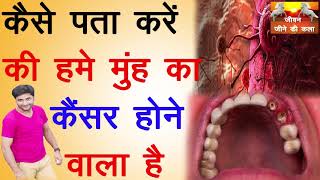 कैसे  पता करें की हमे मुँह का कैंसर होने वाला है [ Mouth cancer ! sign and symptoms ]