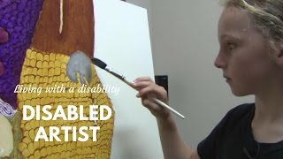 Talented Artist Living with Hip Dysplasia