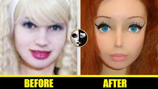 Lolita Richi - 👧 Barbie Doll Plastic Surgery Before and After 👧 - ( Hot Beautiful Girls )