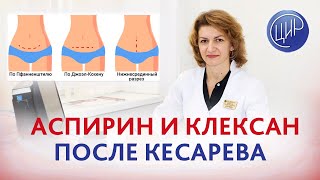 Клексан и Тромбо Асс после кесарева сечения. Отвечает врач акушер-гинеколог ЦИР Дементьева С.Н.