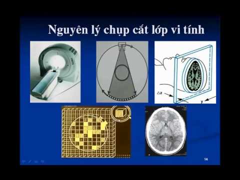 Chẩn đoán hình ảnh thần kinh