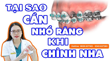Tại sao cần nhổ răng khi niềng răng?