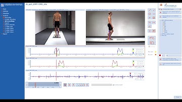 record hardware devices // CONTEMPLAS MULTI CAMERA SYSTEM®