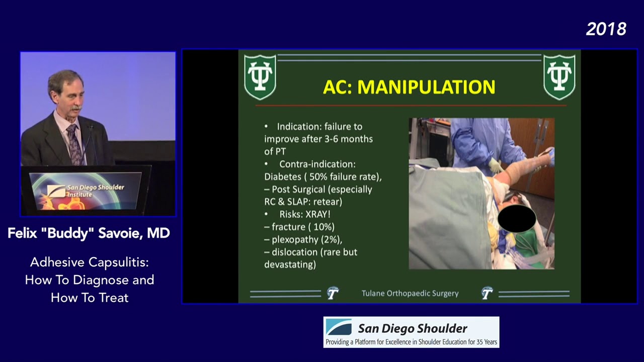 Adhesive Capsulitis How to Diagnose and How to Treat YouTube