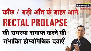 बड़ी आँत बाहर आना || काँछ || Rectal prolapse || Natural homeopathic remedies with symptoms