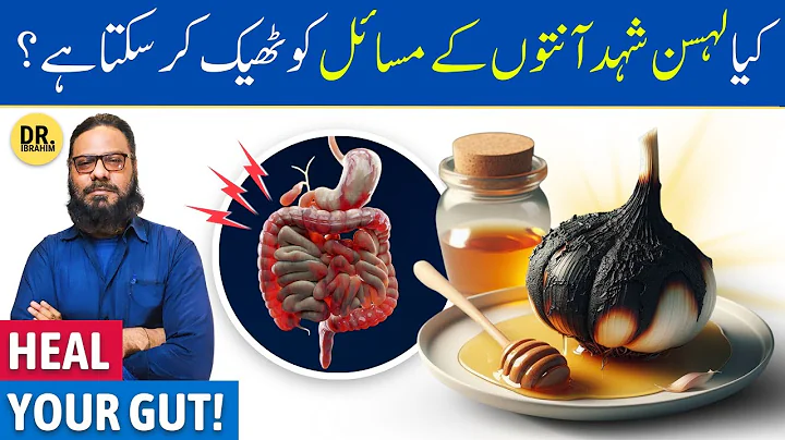 Lehsun Aur Shehad Ke Tilismati Fayde | Garlic Honey | Gale, Pait, Anton Ke Ulcers | Dr. Ibrahim