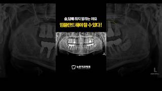 [부산임플란트치과] 술, 담배 하지 말라는 이유, 임플란트 해야 할 수 있다 ! #shorts