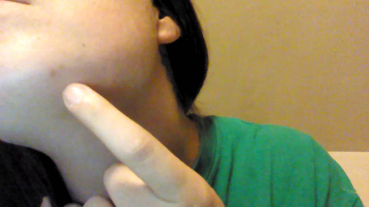 Equate Beauty Acne System/Does it work? #6