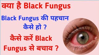 क्या है Black Fungus, कैसे करें Black Fungus की पहचान,Black Fungus के बचाव कैसे करें