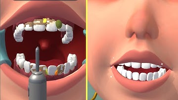 ✅Perfect Smile 3D in All Levels Gameplay Walkthrough Android, ios Updates - Mobile Game Max Levels