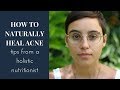 How to naturally heal acne: Tips from a holistic nutritionist