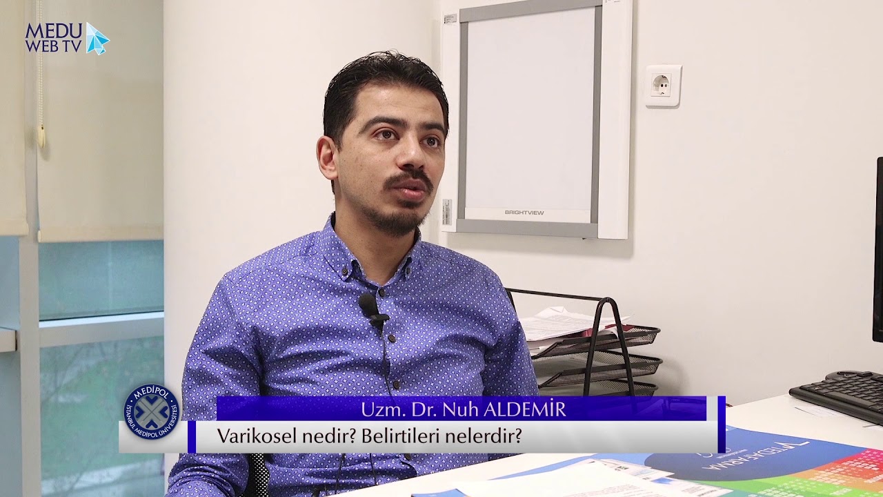 Belirtiler ve tedavi varikosel Belirtiler ve tedavi varikosel