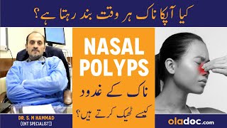 Nasal Polyps Ka Ilaj - How To Treat Nasal Polyps - Nak Ke Gadood Ka Ilaj - Nasal Polyps Symptoms