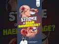 Stroke vs Brain Haemorrhage: What's the Difference? | Expert Neurosurgeon Explains