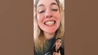 Aligners and Crooked Teeth #invisalign