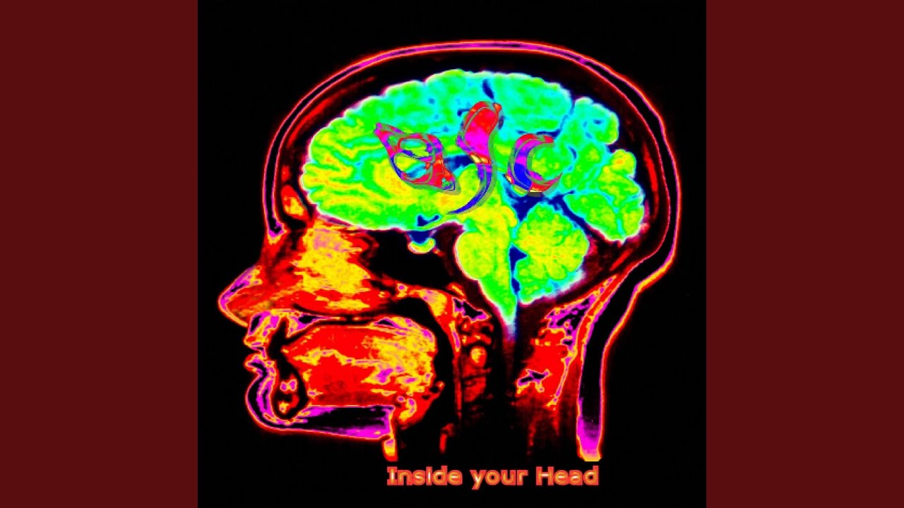 Watch Optic Chiasm on YouTube Watch Optic Chiasm on YouTube