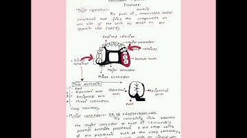 Components of Removable Partial Denture| EASY|