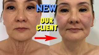 How To Get Rid Of Sagging Neck Wrinkles On The Neck The Best From Mage Do It With Me