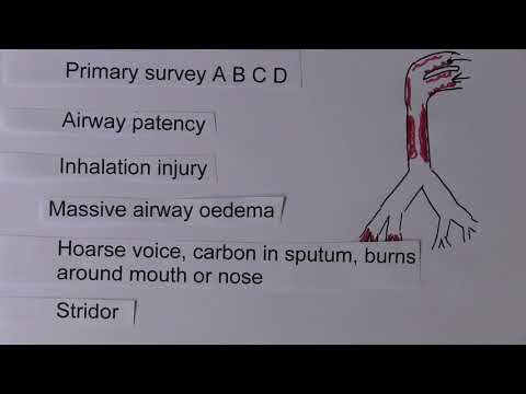 Burns 9, Systemic effects - Airway and Breathing