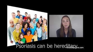 How to Get Rid of Psoriasis Part 1