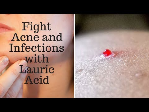 Fight Acne and Infections with Lauric Acid