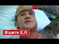 Surgery on a broken jaw that has been left for 10 days  bizarre er