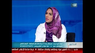 حلقة مهمة عن كيفية علاج كلف البشرة والتصبغات والاسمرار | د. علا الشربيني