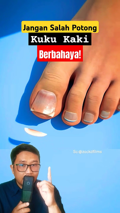 Don't Cut Your Toenails Wrongly. It's Dangerous! #shorts #education #science #nails