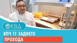 ВПЧ 11 заднего прохода. Клинический случай №61