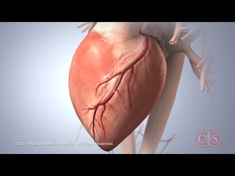Symptoms of Sudden Cardiac Arrest | Cedars-Sinai