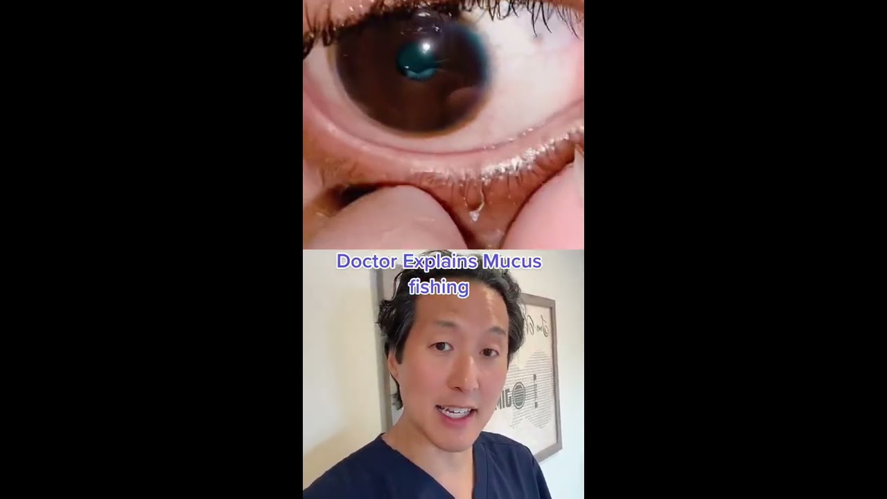 Why You Shouldn T Fish For Mucus In Your Eyes Shorts Mucusfishing