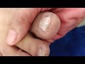 Pedicure May 2 #satisfying Neldz SOLO Parent  is live!