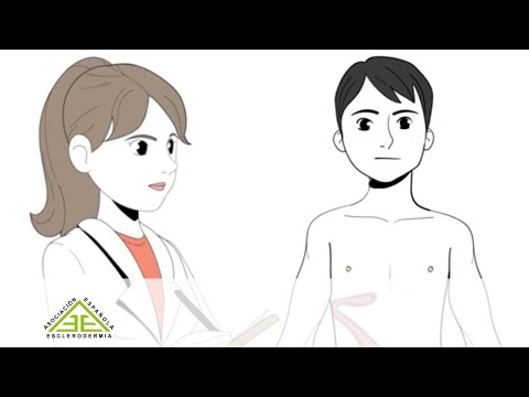 Video: ¿La morfea afecta el embarazo?