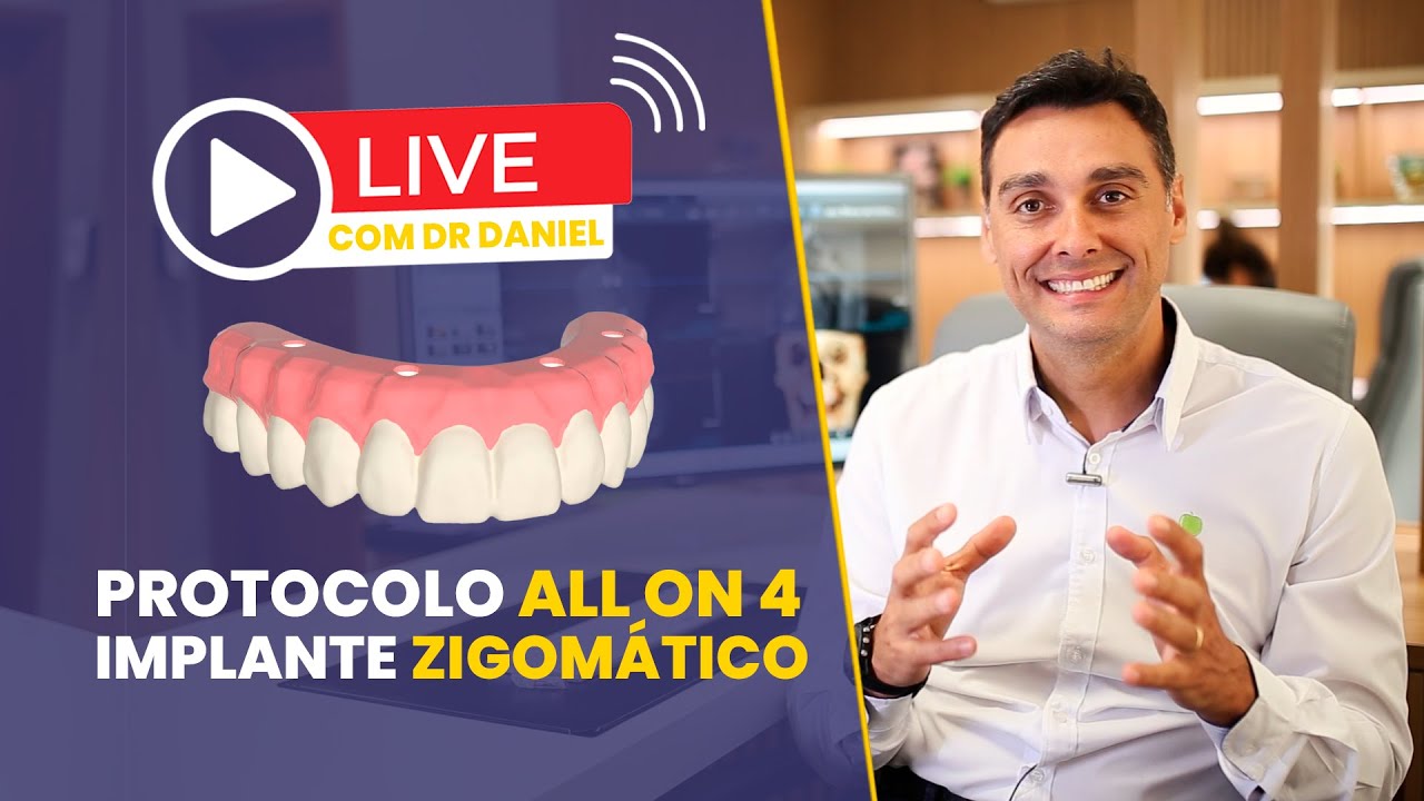 Implantes Zigomáticos e All on 4 - Live Protocolo Implace
