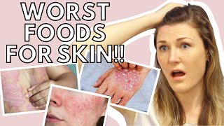 Top 5 WORST FOODS for Eczema (AVOID THESE) | WORST FOODS for skin Inflammation