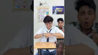 Spider Bite 🕷️😨😭|| Pura dekho😱|| piyush khubnani || #shorts #ytshorts #trending