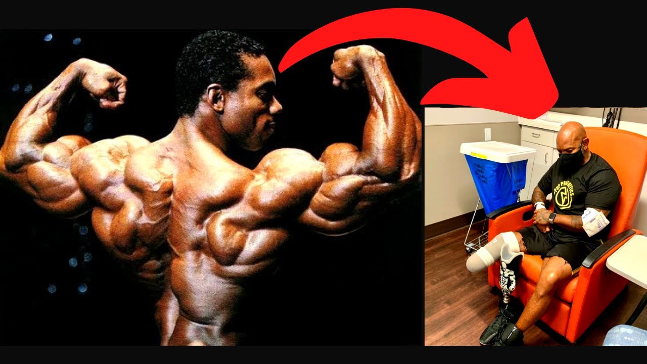 PORQUE FLEX WHEELER PERDIÓ UNA PIERNA