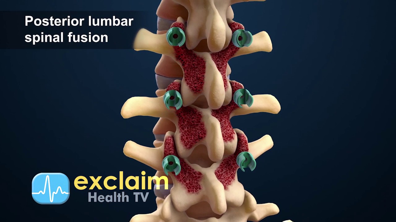 3D Animated Patient Education Content