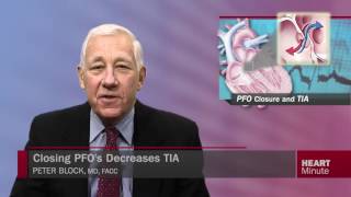 Heart Minute | Closing PFO’s Decreases TIA