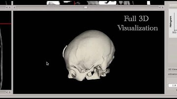 User Interaction for Medical Image Analysis