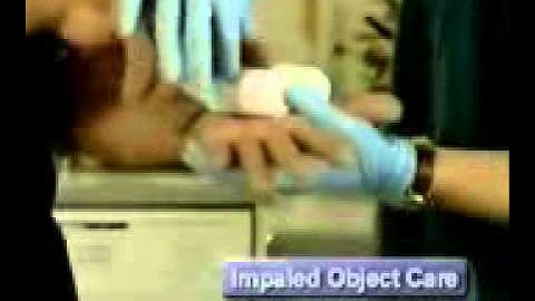 Medical Videos   Impaled Objects