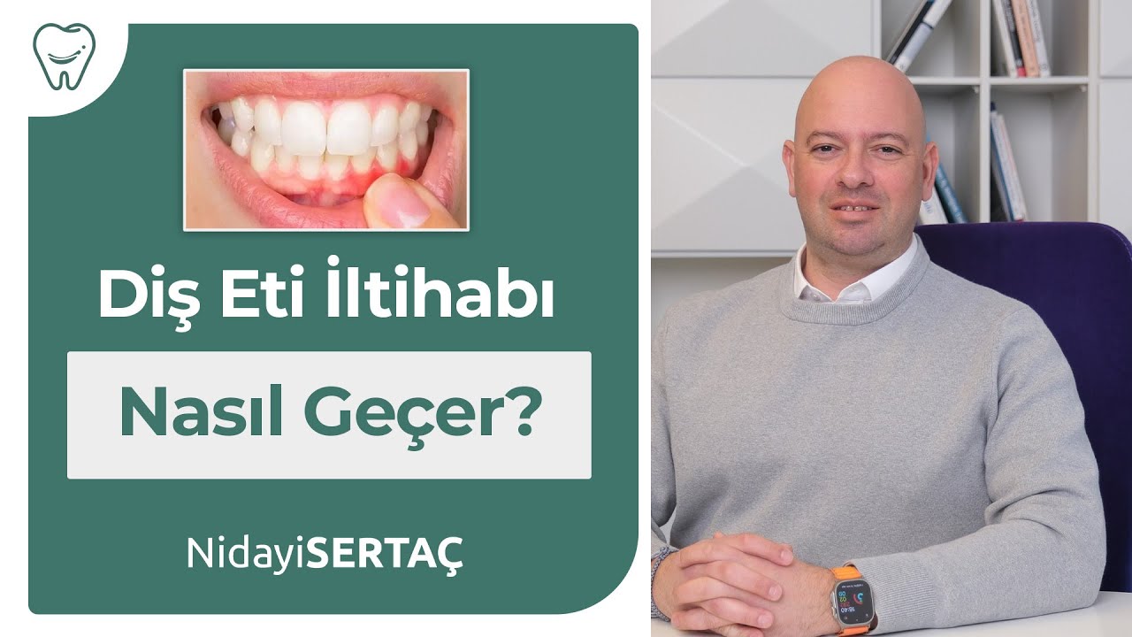 Diş eti iltihabı nasıl geçer ?