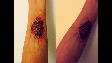 3rd degree burn makeup fx