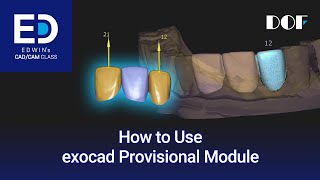 How to Use exocad Provisional Module