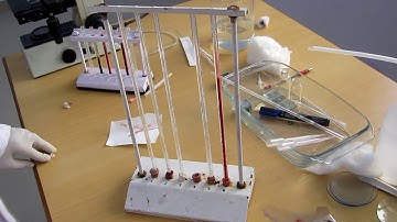 Erythrocyte sedimentation rate
