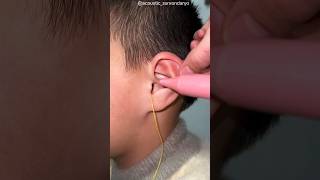 The doctor put liquid in the boy's EAR #shortsvideo