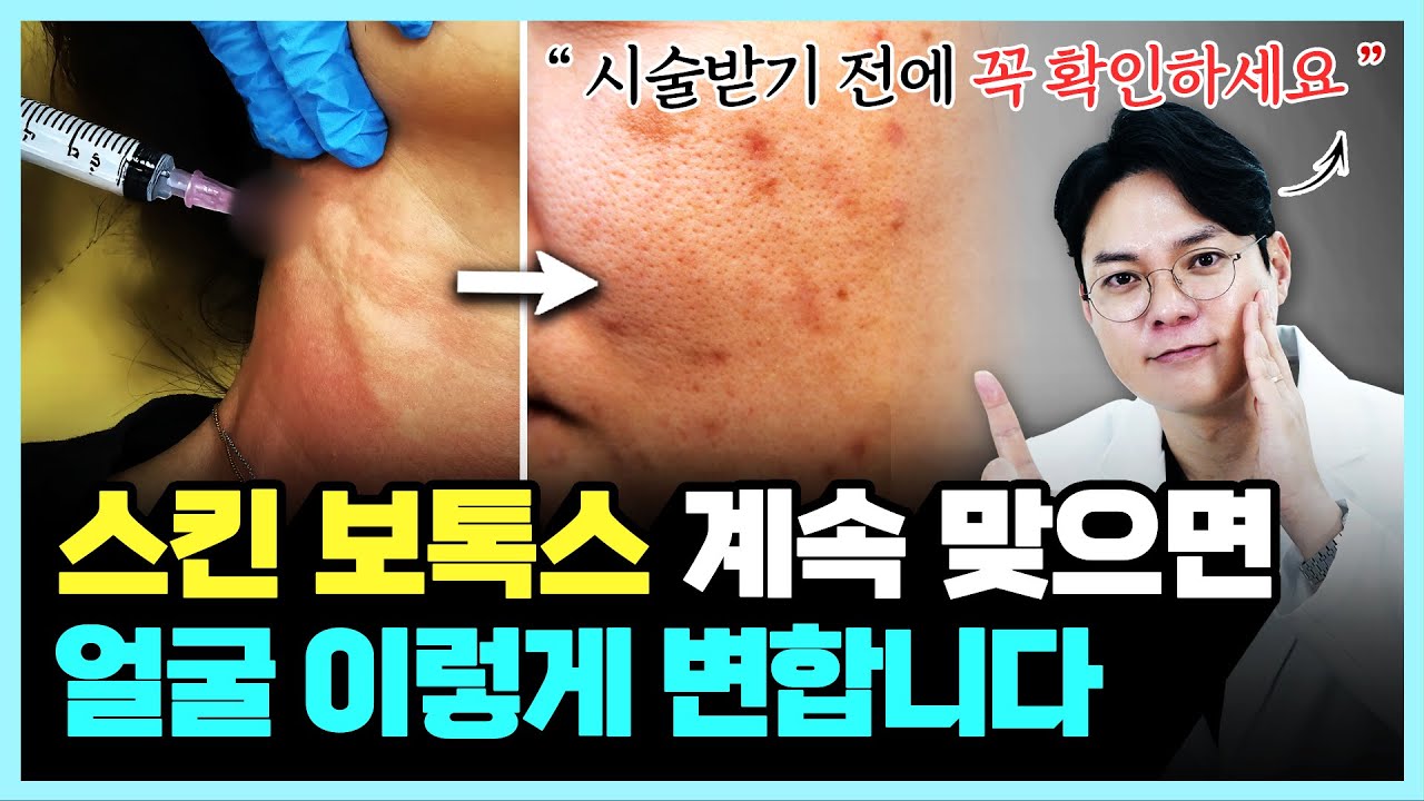스킨보톡스 이거 모르고 '이렇게' 맞으면 오히려 돈만 날립니다.ㅣ동탄 40대 의사가 알려주는 스킨보톡스의 진실