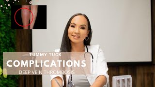 Deep Vein Thrombosis | Tummy Tuck Complications | VitaPlug