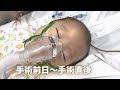 難病と闘う 15時間の手術に耐えた1歳娘 難病と闘う 15時間の手術に耐えた1歳娘