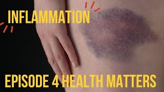 Health Matters Episode 4 Inflammation